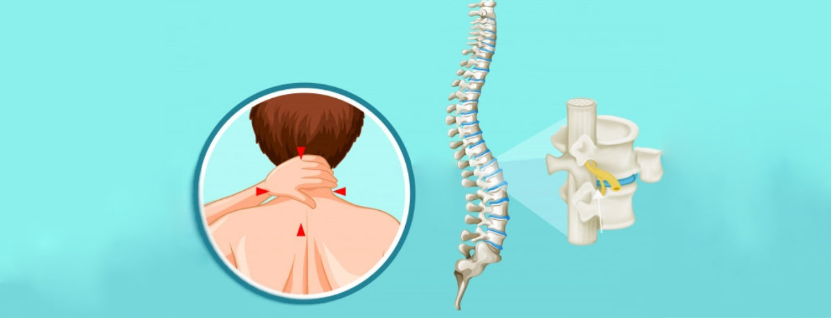 Spinal Cord Stimulation Spinal Cord Stimulation