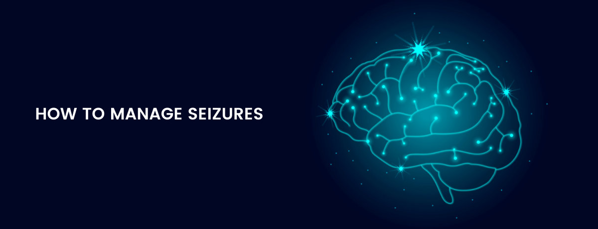 How to Manage Seizures? How to Manage Seizures?