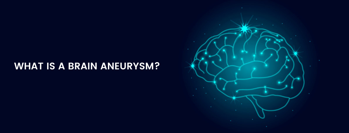 How to deal with Brain Aneurysm? How to deal with Brain Aneurysm?