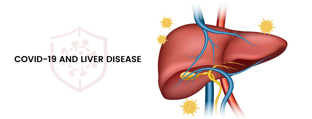COVID-19 and Liver Disease COVID-19 and Liver Disease