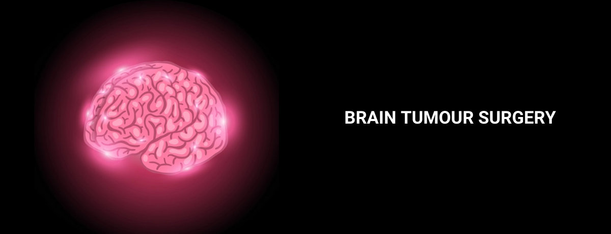 Brain Tumour Treatment Brain Tumour Treatment