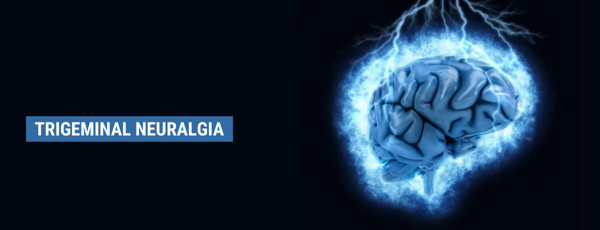 Trigeminal Neuralgia Trigeminal Neuralgia