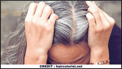 Causes of premature greying of hair  The Statesman