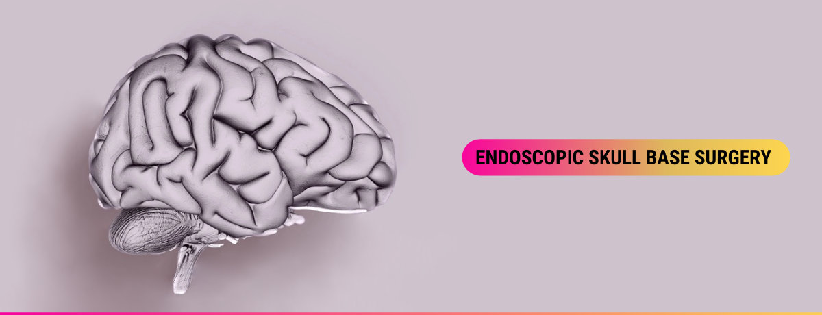 Endoscopic Skull Base Surgery Image Endoscopic Skull Base Surgery Image