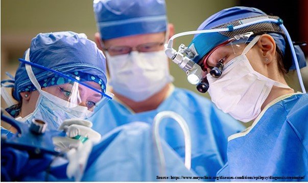 Why is Epilepsy Surgery Performed