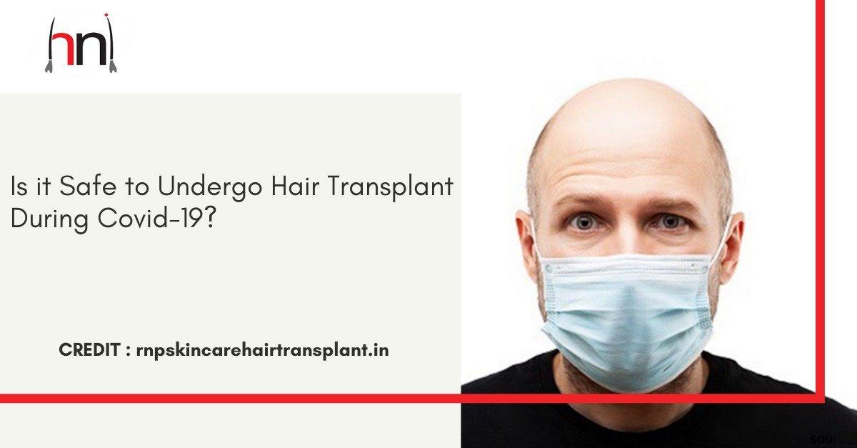 Image shows hair transplant is safe or not in COVID-19