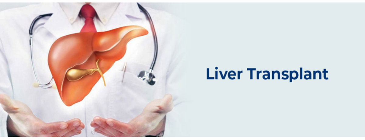 Is your parent going for a liver transplant? Is your parent going for a liver transplant?