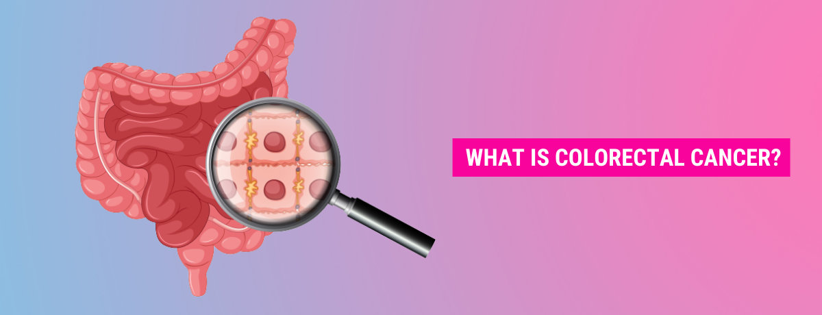 What is colorectal cancer What is colorectal cancer