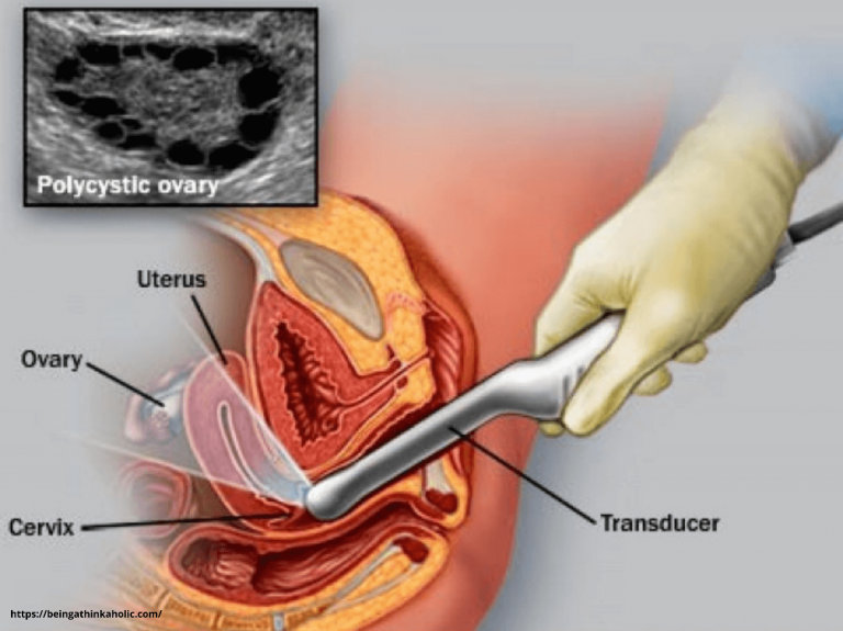 cost of follicular monitoring