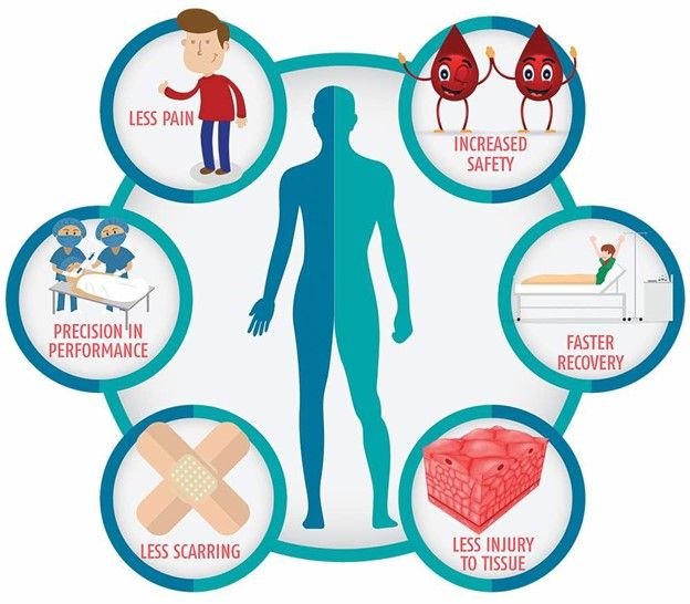 benefits of laparoscopic surgery