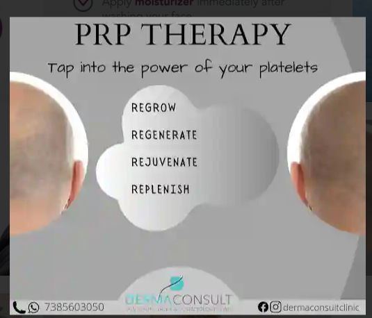 PRP Therapy