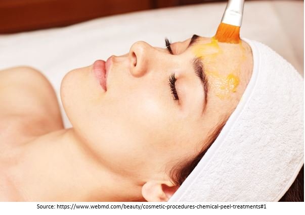 Chemical peels