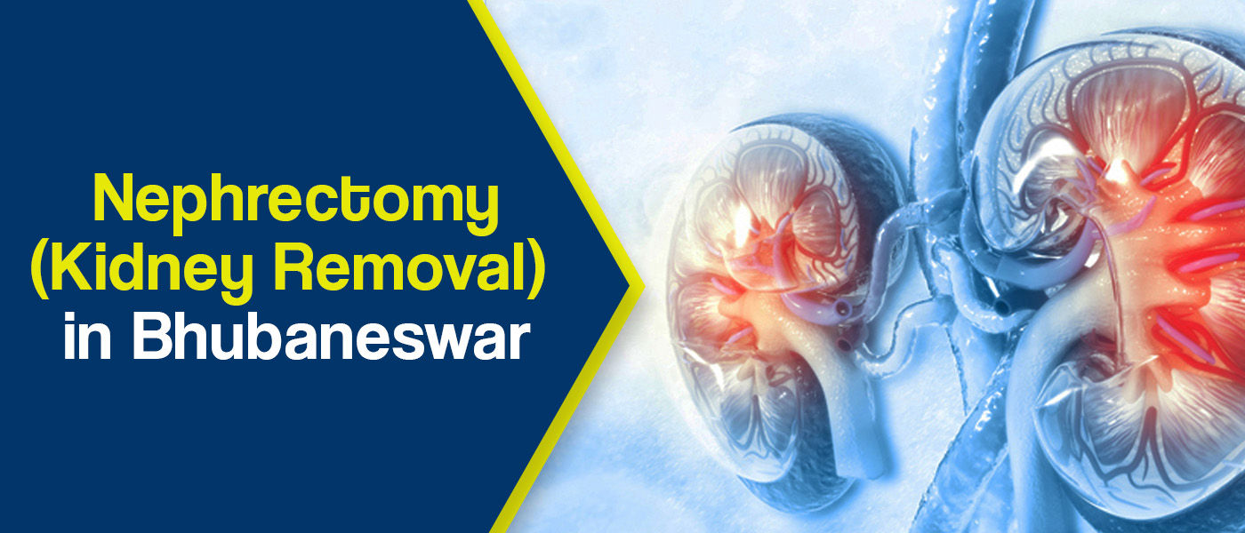 Nephrectomy (Kidney Removal) in Bhubaneswar