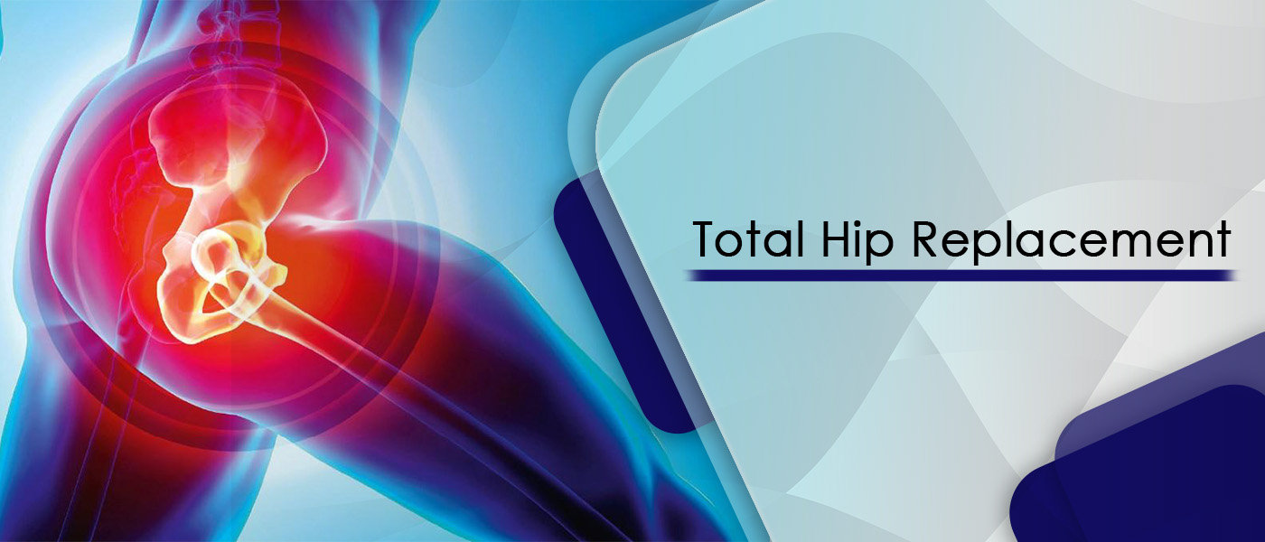 Hip Replacement