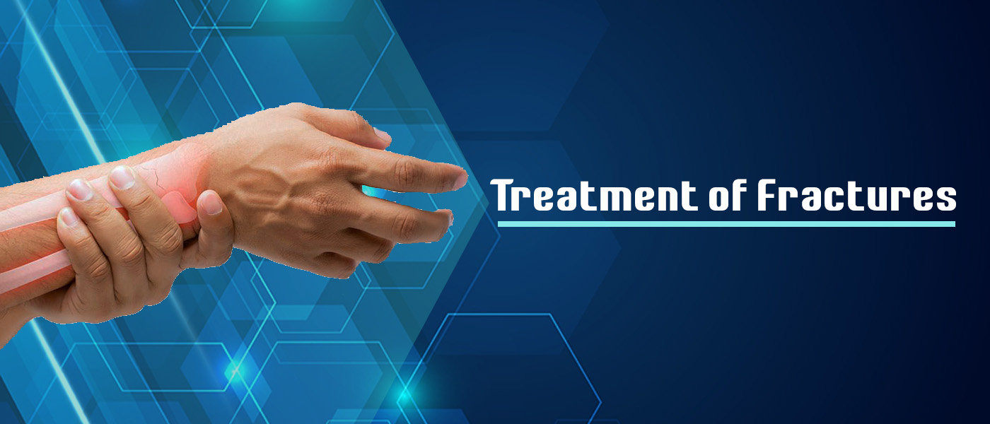 Fracture Treatment Fracture Treatment