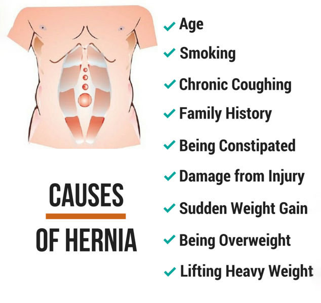 Let’s know the Causes of Hernia