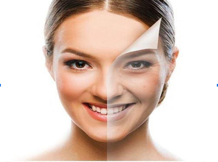 Chemical Peel Chemical Peel