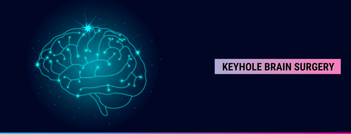 What Is Keyhole Brain Surgery What Is Keyhole Brain Surgery