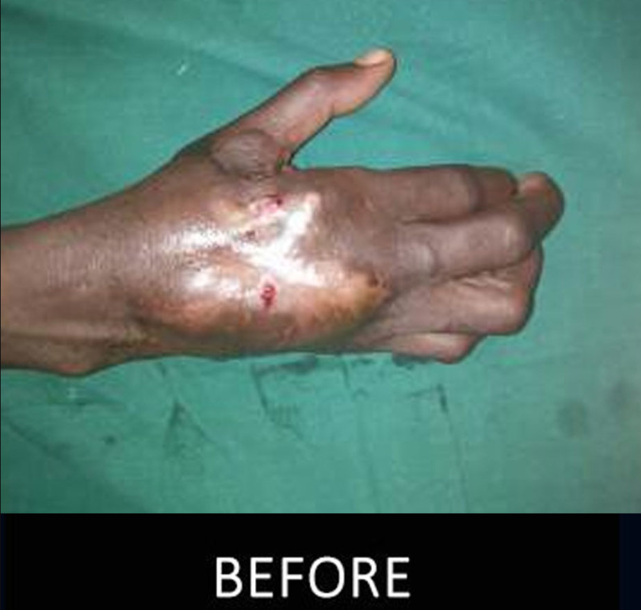 Before Image Before Image