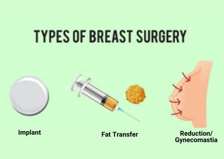 Breast Surgery in Mumbai