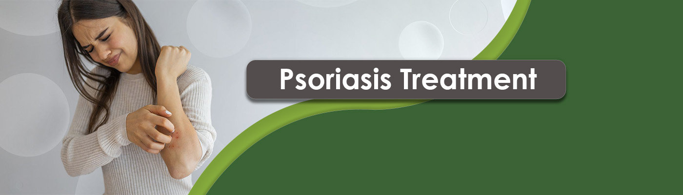 Psoriasis Treatment