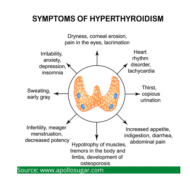 hyperthyroidism