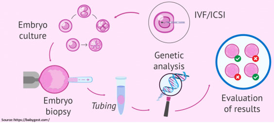 Preimplantation Genetic Screening