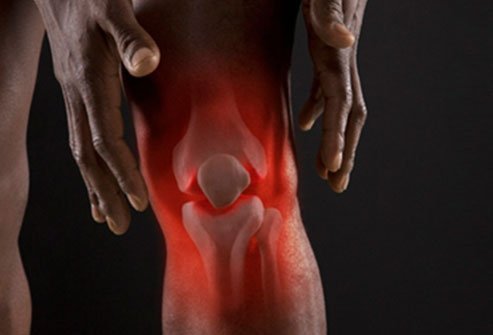 Knee Replacement