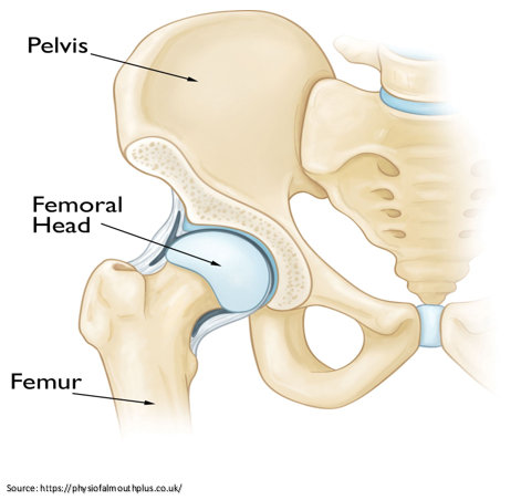  Hip Replacement