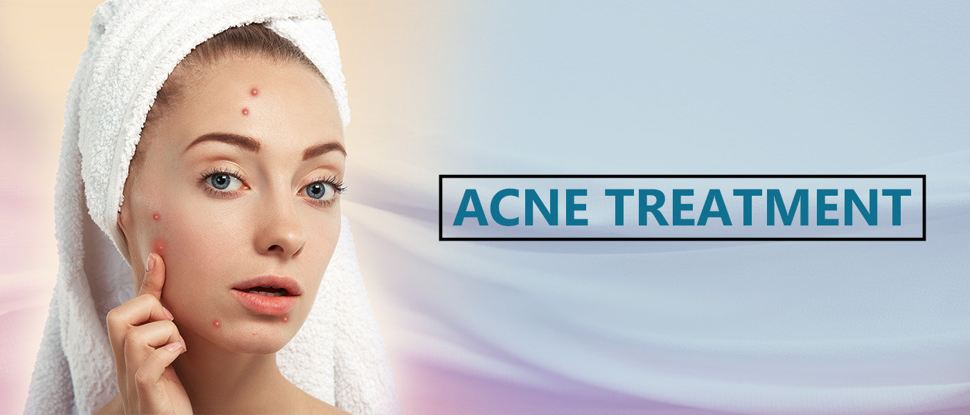 Acne Treatment Acne Treatment