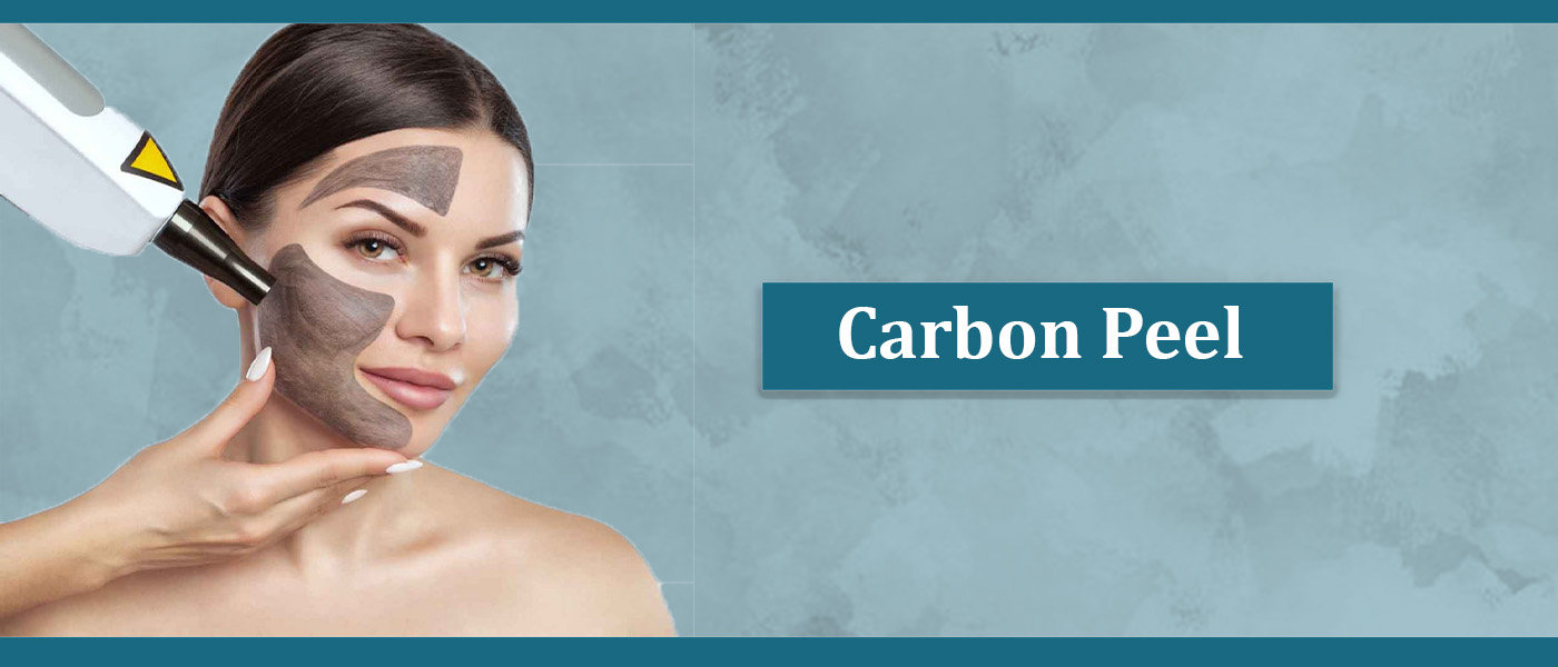 Carbon Peel Carbon Peel