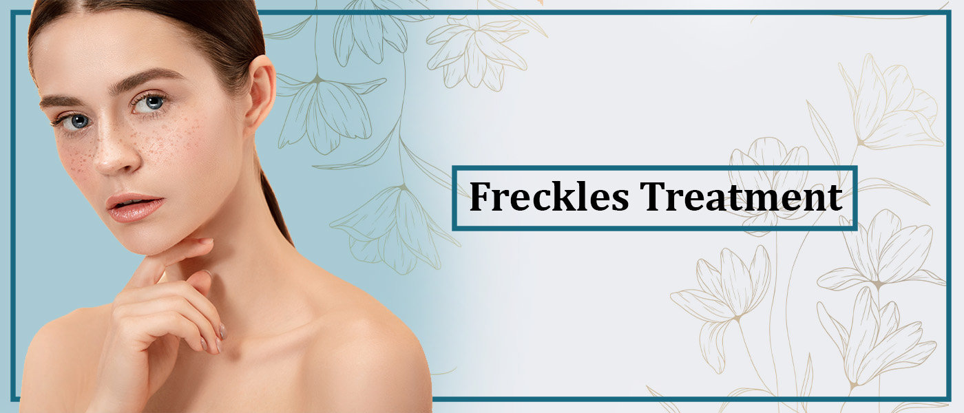 Freckles Treatment Freckles Treatment