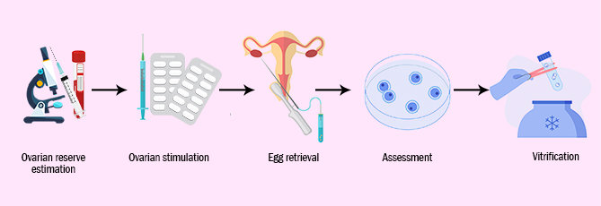 oocyte cryopreservation