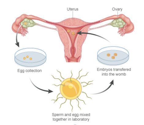 embryo cryopreservation