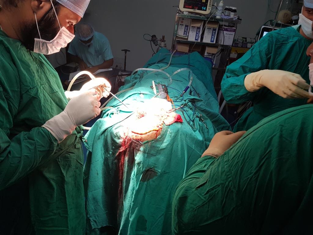 Dr Gurneet in a Surgery Dr Gurneet in a Surgery
