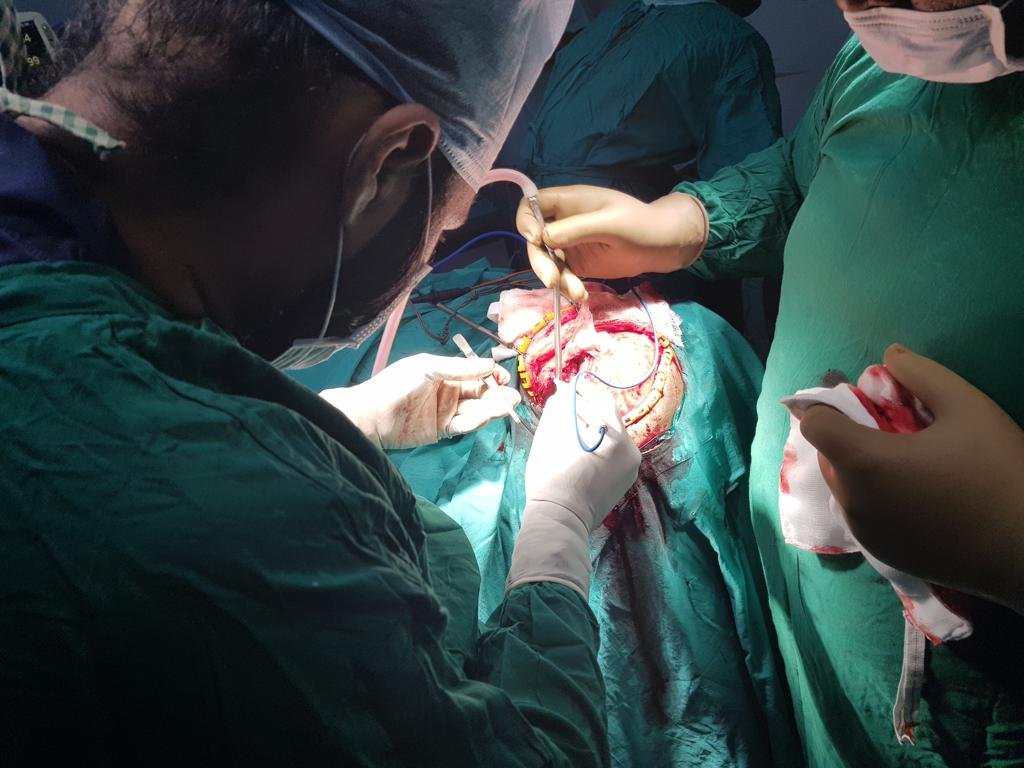 Dr Gurneet in a Surgery Dr Gurneet in a Surgery