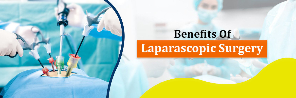 Benefits of Laparoscopic Surgery Benefits of Laparoscopic Surgery