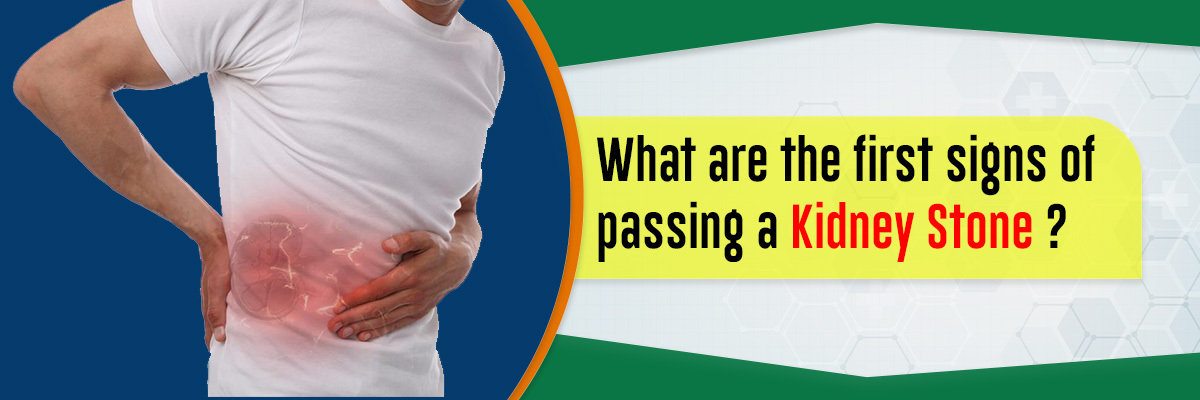 signs of passing a kidney stone