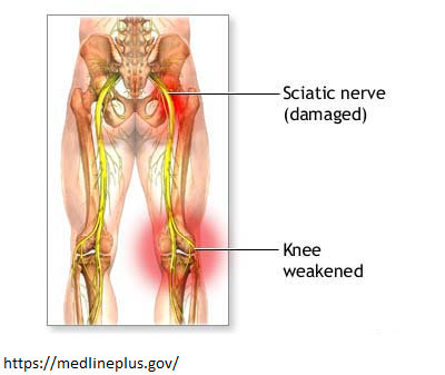 risks of knee replacement surgery