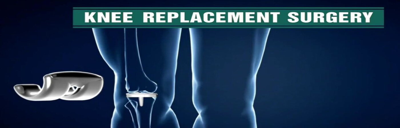 Total Knee Replacement