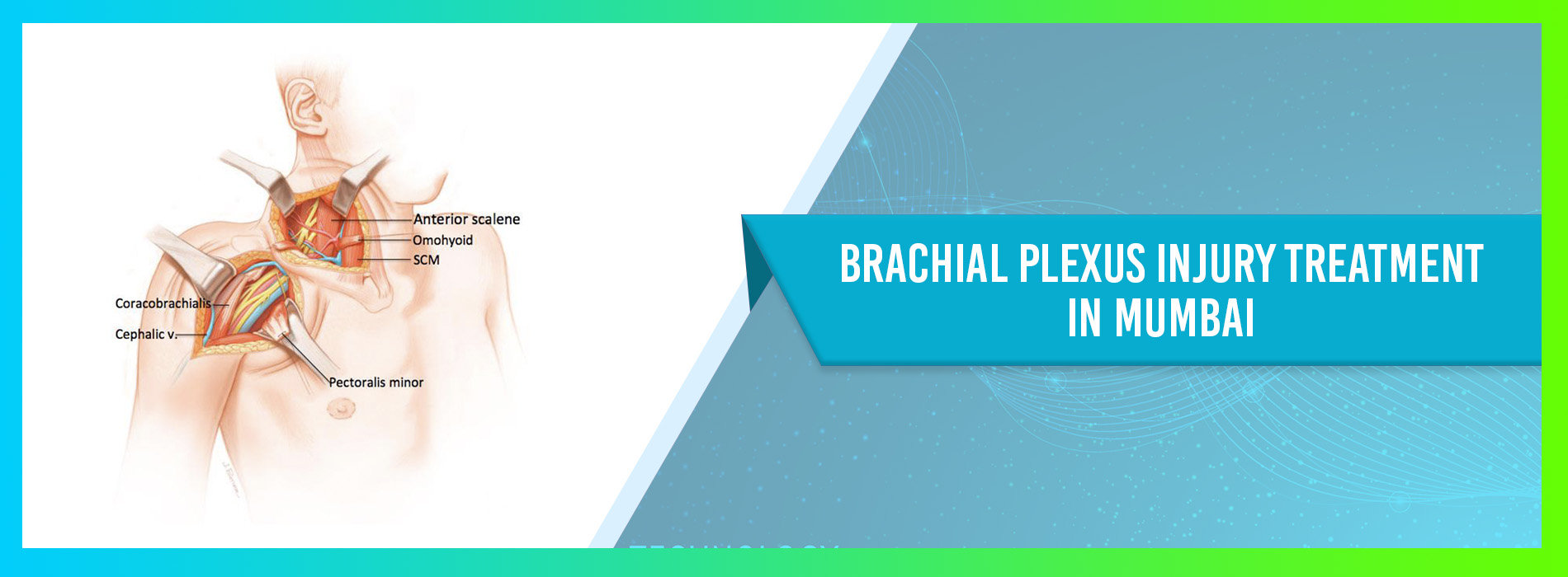 Brachial Plexus Injury Treatment Brachial Plexus Injury Treatment