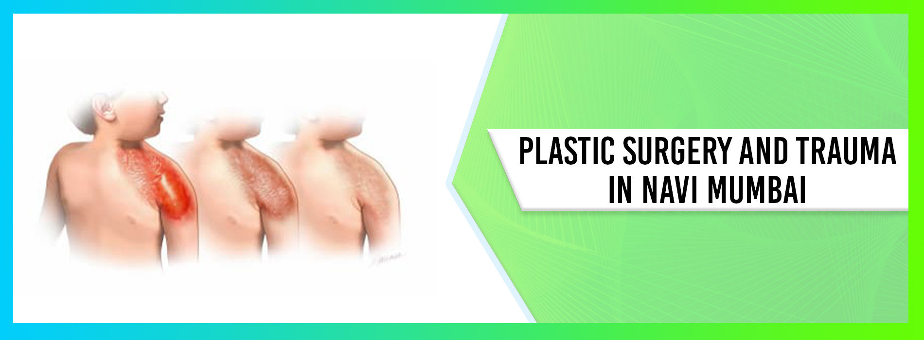 Plastic Surgery and Trauma Plastic Surgery and Trauma