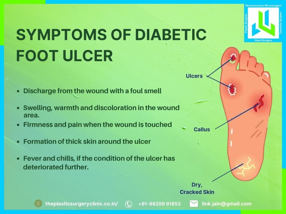 Diabetic Ulcer Treatment In Mumbai Dr Leena Jain 0671