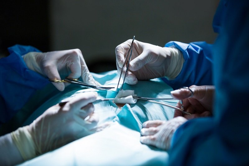 Laparoscopic surgery