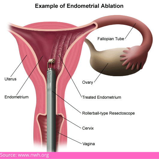 menstrual cycles