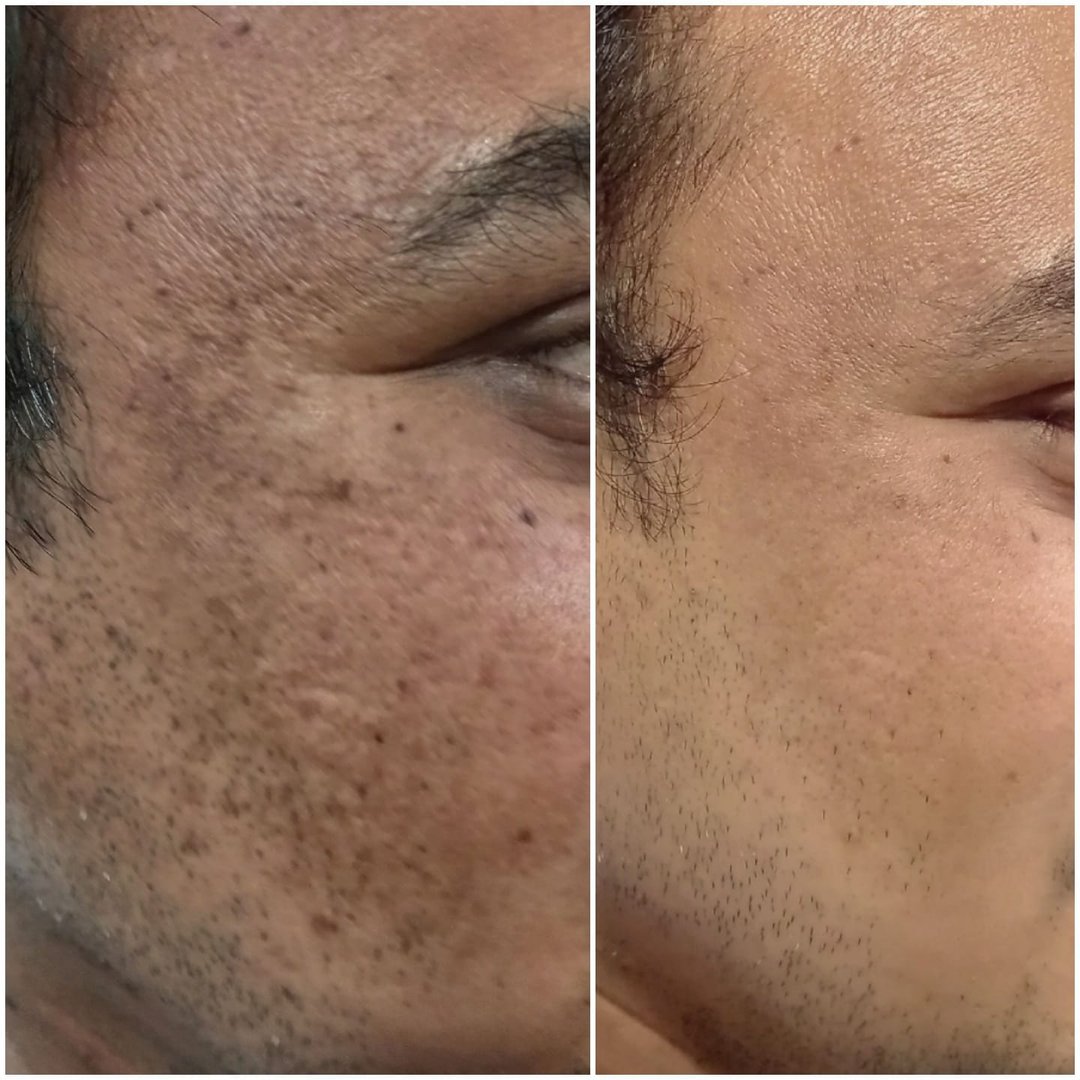 Before After Treatment Before After Treatment