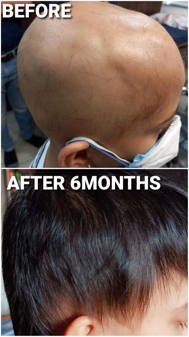 Before and After Before and After