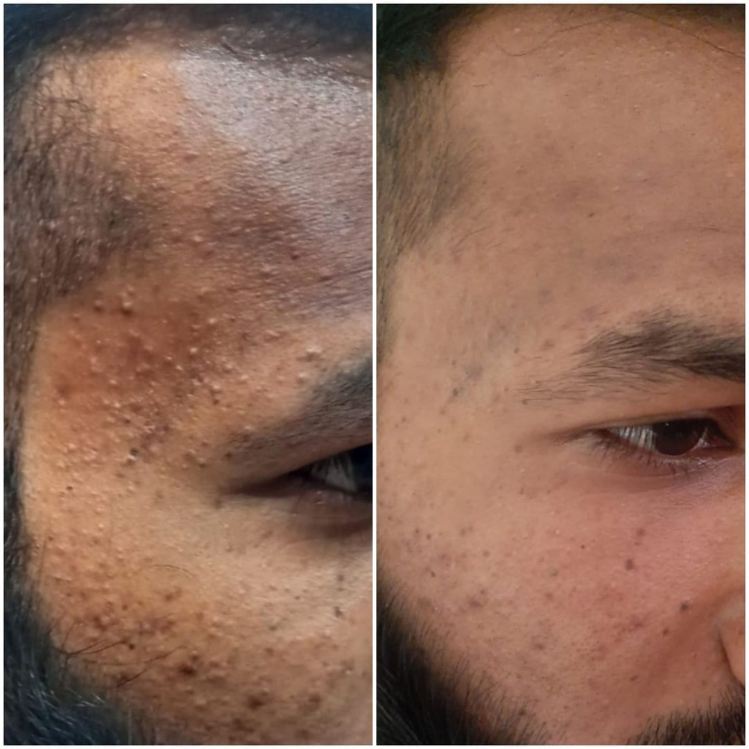 Before and After Before and After