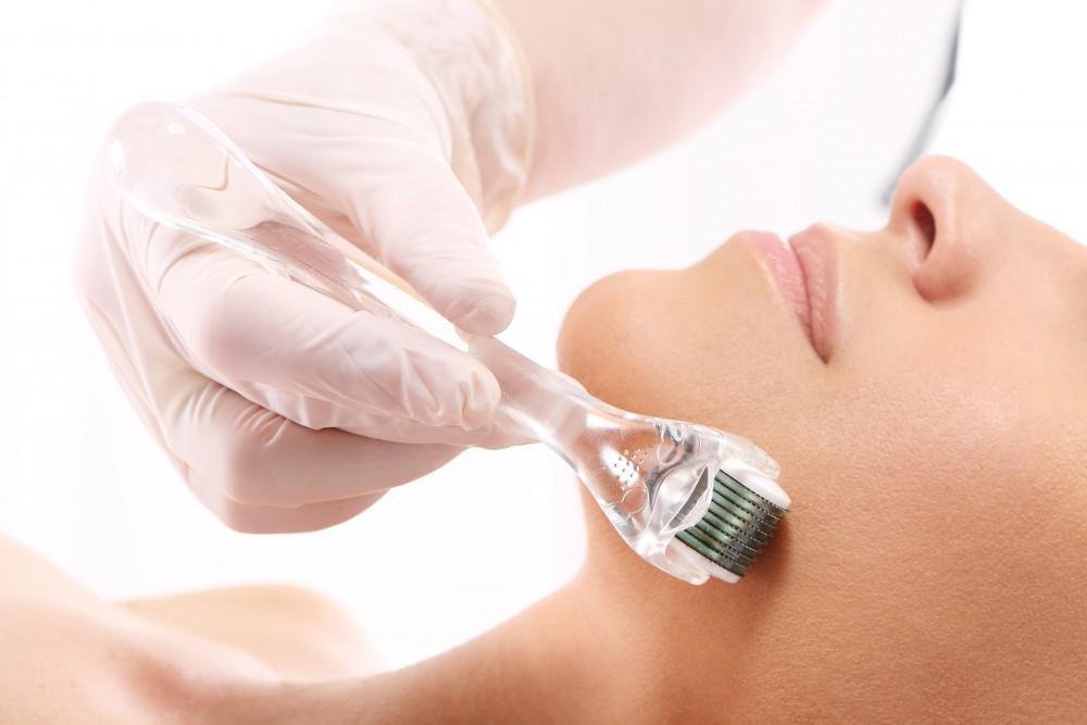 5 Reasons Microneedling Is So Beneficial for Your Skin: Bruce Sanderson, MD: Laser & Medical Spa