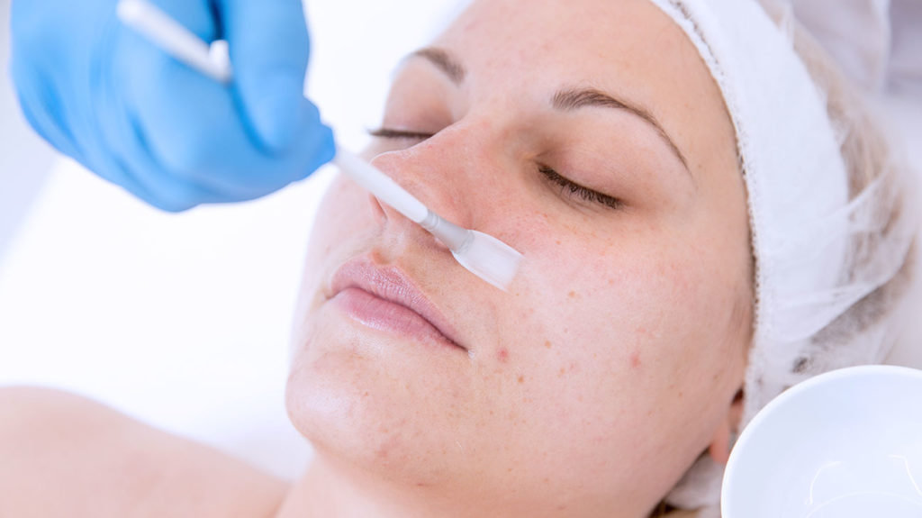 Chemical peels: Do they work?